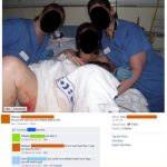 Post labor photo that shows too much