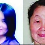 28-year-old Henan woman with rare 'aging' disorder