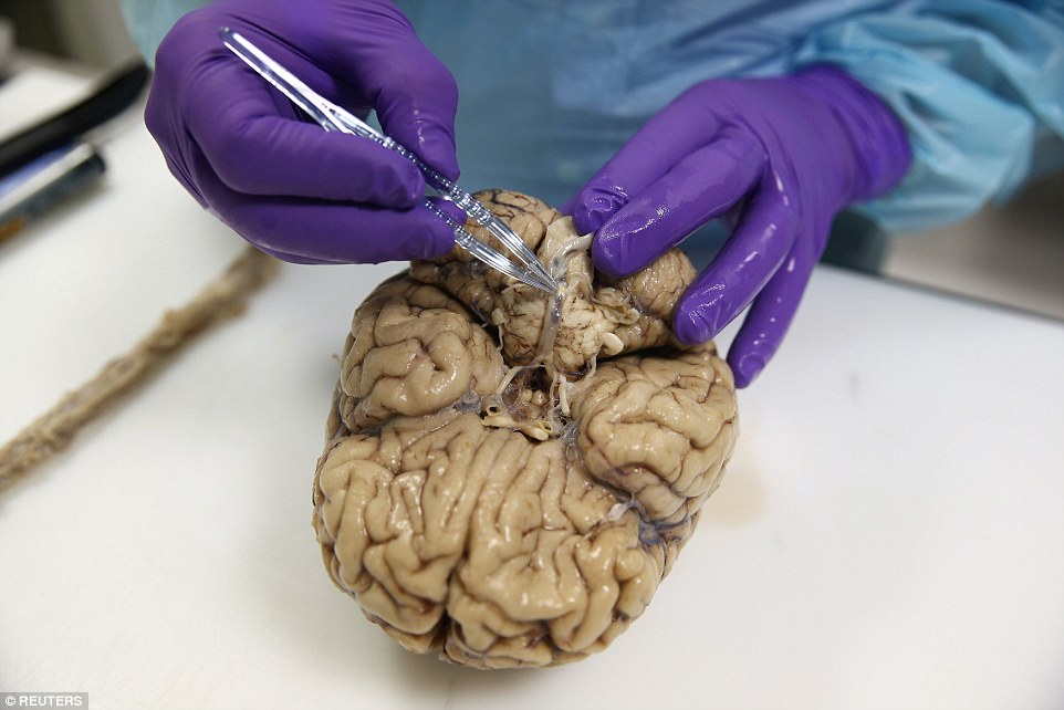 Britain’s biggest brain bank houses 1,650 brain specimens | DailyPedia